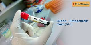 ALPHA FETO PROTEIN 